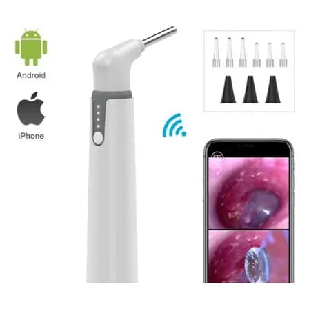 Endoscópio Digital Otoscópio Câmera Ouvido Celular Tablet Medical 3.5v